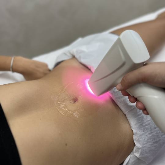 GM Beauty studio #beograd Laserska epilacija Laserska epilacija celog stomaka - za dame