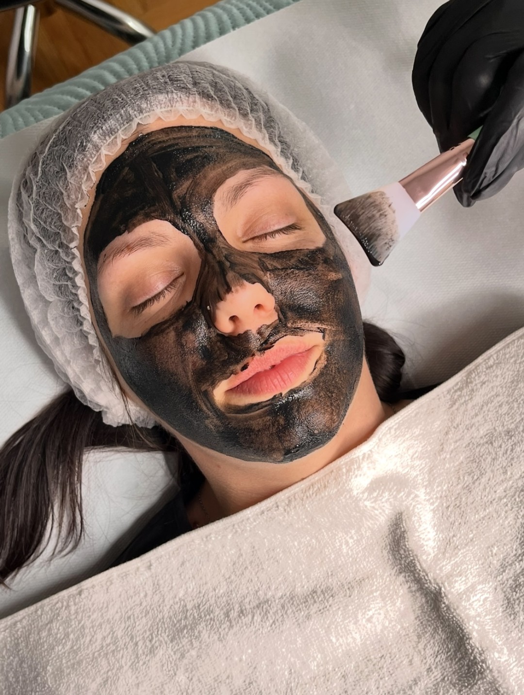 La Hermosa Beauty Studio #beograd Laserski tretmani lica Karbonski piling lica