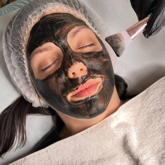 La Hermosa Beauty Studio #beograd Laserski tretmani lica Karbonski piling lica Karbonski piling dubi