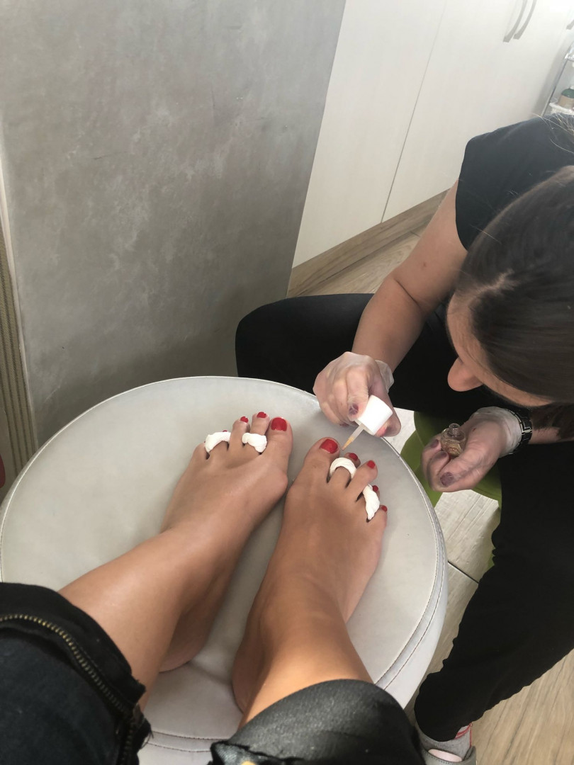 Bibi beauty centar #beograd Medicinski pedikir Medicinski pedikir + lakiranje noktiju
