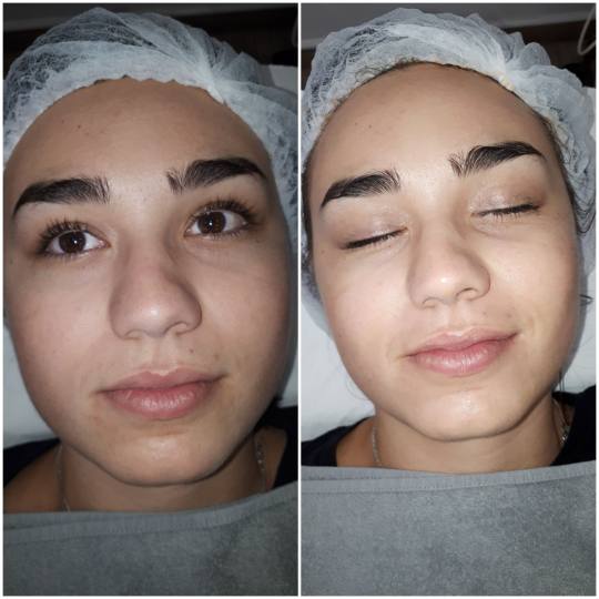 Essence of Beauty Academy #beograd Tretman lica Karbonski tretman lica Klijentkinji smo radili BB Gl