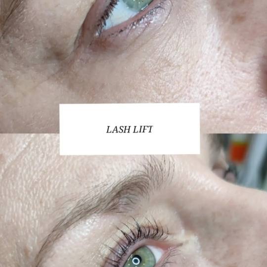 Laser lab by Ceca usluga