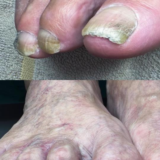 Dals Studio by Anica #novisad Medicinski pedikir Medicinski pedikir - jako zahtevan *Medicinski pedi