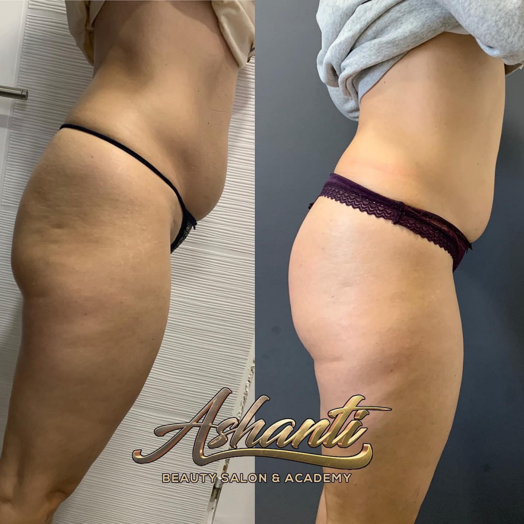 Ashanti Beauty Salon & Academy #beograd Masaža za mršavljenje