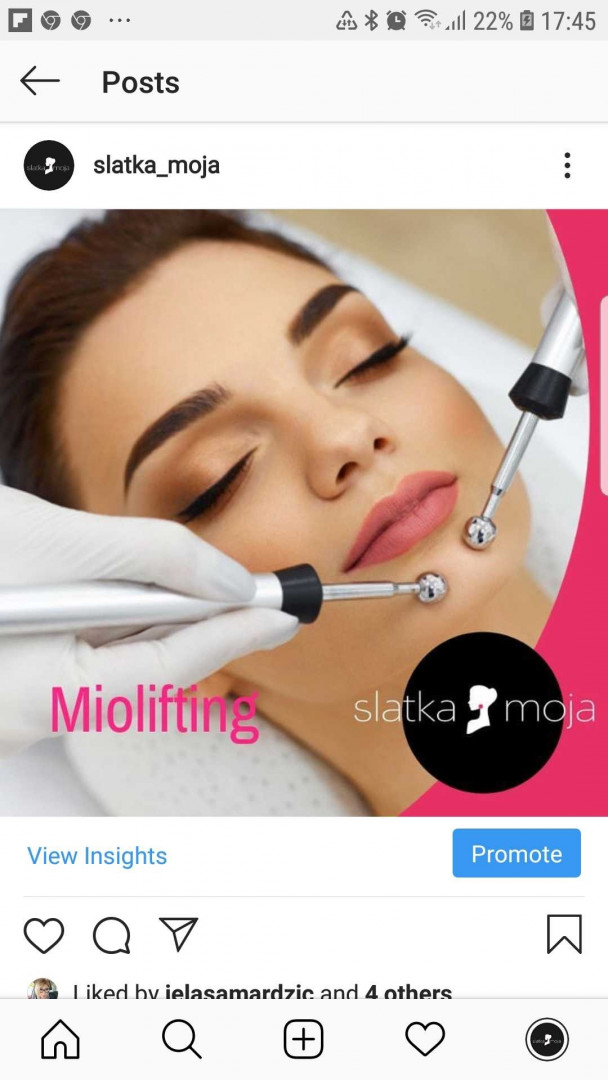 Miolifting - lice - Slatka moja, Beograd Tretman lica Lice Tretman lica, Beograd, Novi Beograd blokovi, Belville, Savski kej