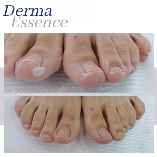 Derma Essence #nis Estetski pedikir Standardni pedikir