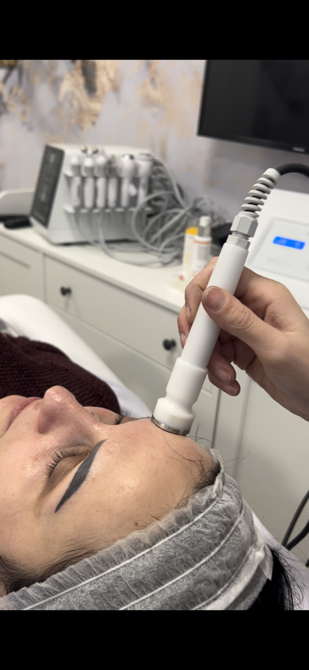 Step up beauty #beograd Tretman lica Mezoporacija lica - anti wrinkles
