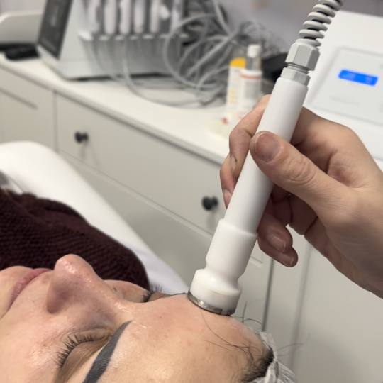Step up beauty #beograd Tretman lica Mezoporacija lica - anti wrinkles