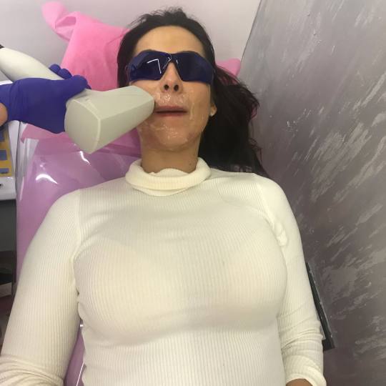 Body Beauty Balance 2020 #beograd Laserska epilacija