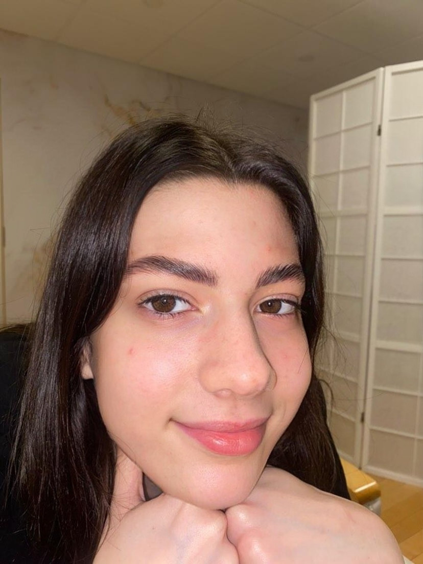Brow lift +farbanje obrva+ botox - Esthetique Privé, Beograd Obrve Lice Obrve, Beograd, Centar, Stari grad, Dorćol