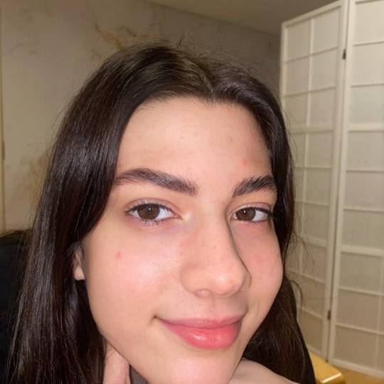 Esthetique Privé #beograd Obrve Brow lift +farbanje obrva+ botox