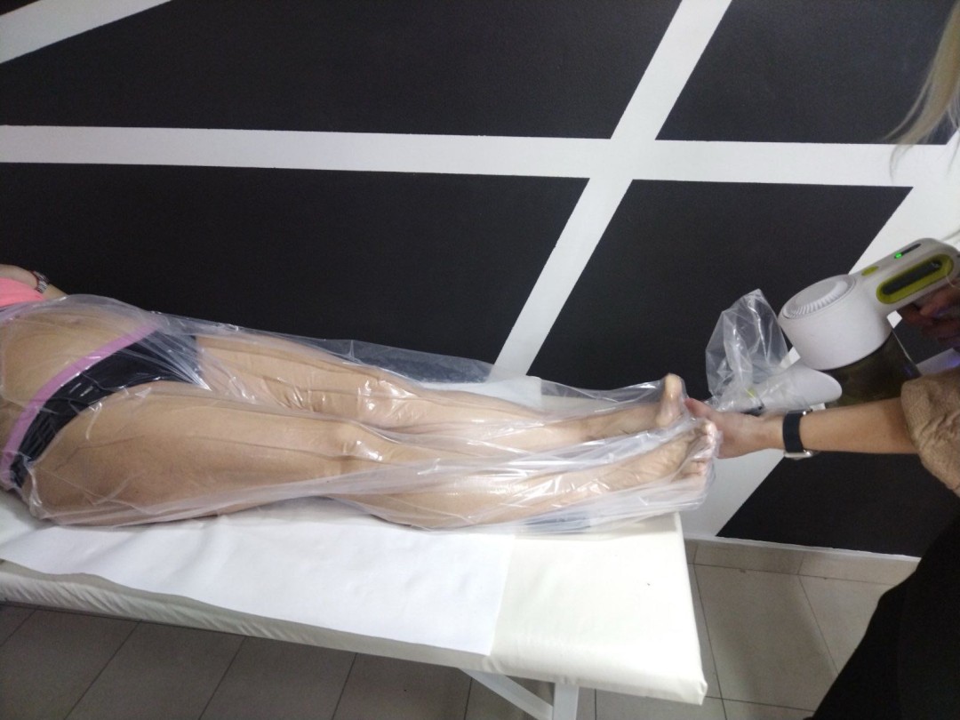 Studio Adore #novisad Tretmani za mršavljenje Vacuuslim 48 tretman - noge + stomak