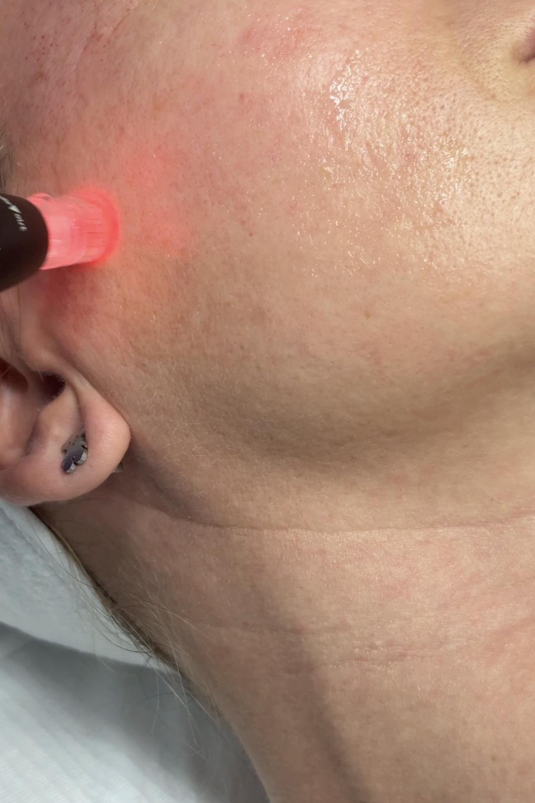 Estetik MPL 87 #beograd