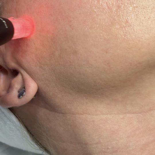 Estetik MPL 87 #beograd