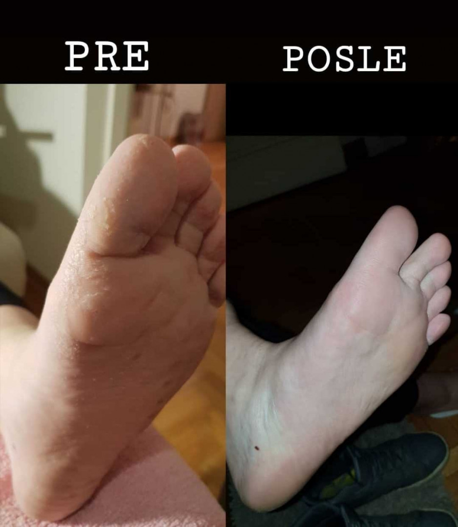 Just You Beauty & Nails #beograd Medicinski pedikir