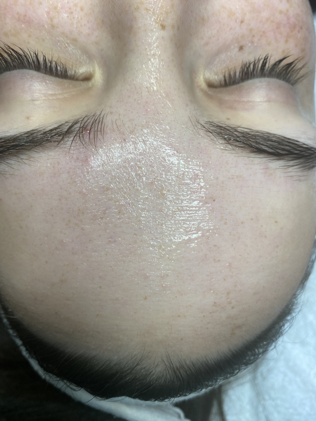 Hydra Facial - Prestige, Beograd Tretman lica Lice Tretman lica, Beograd, Vračar, Čubura, Crveni krst