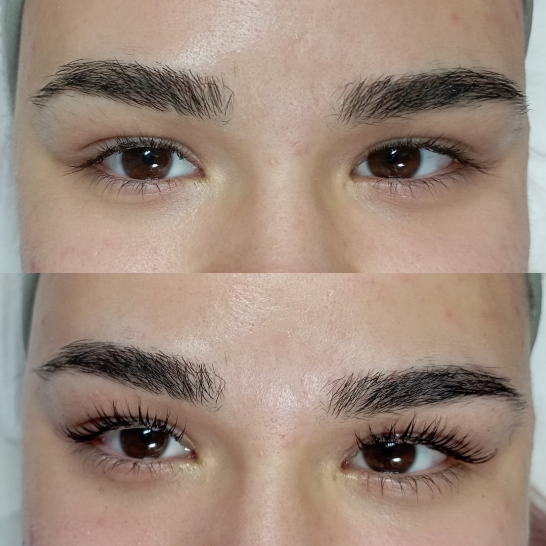 Factor Estetic #beograd Trepavice