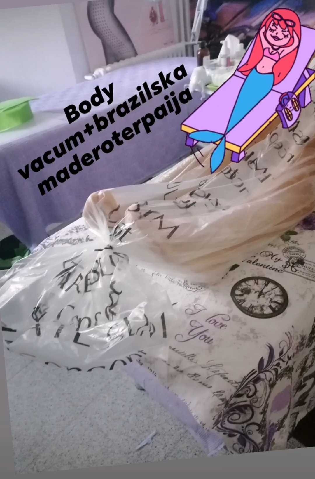 Studio Olja Diego #beograd Anticelulit Body vacuum