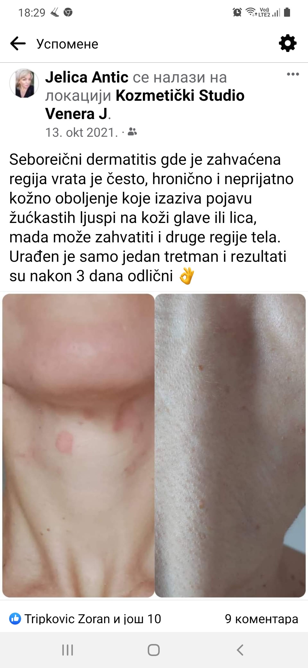 Studio Venera J #beograd Tretman lica Higijenski tretman lica