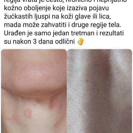 Studio Venera J #beograd Tretman lica Higijenski tretman lica