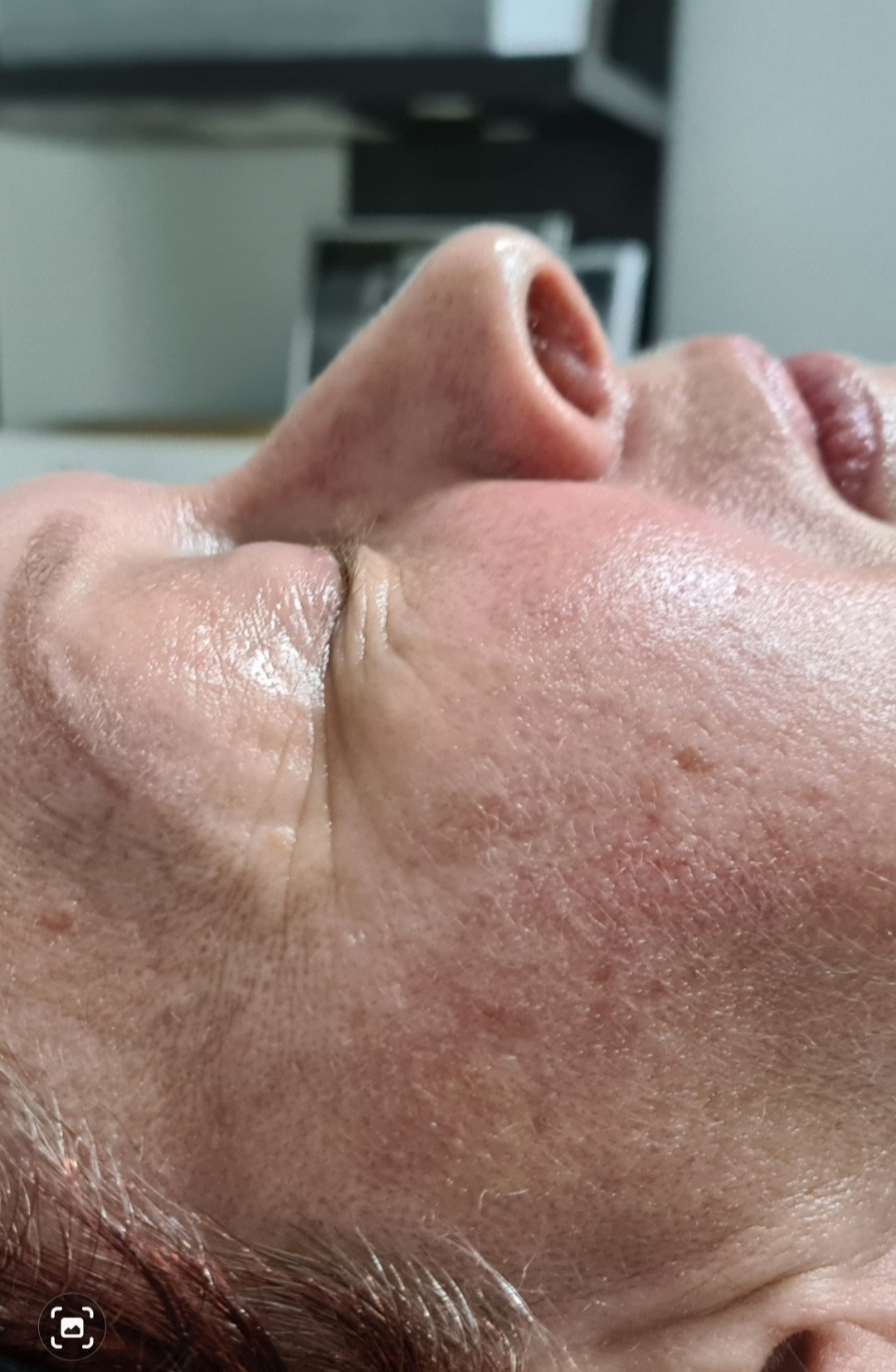 SunBox #beograd Masaža lica Face gym / Face fitness - anti age masaža lica