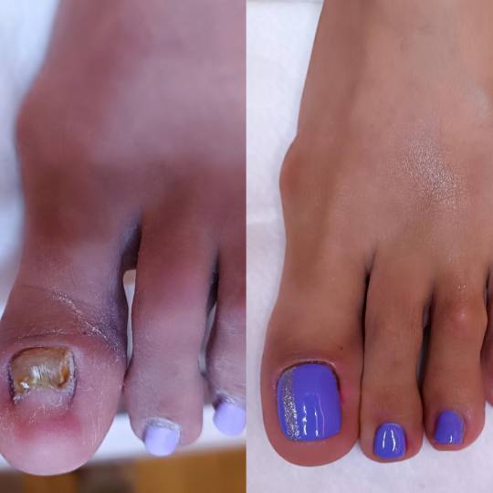 Golden Beauty Shop #beograd Gel lak Antifugalni gel - rekonstrukcija nokta
