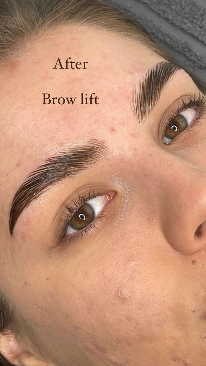 Studio Omega #novisad Obrve Brow lift