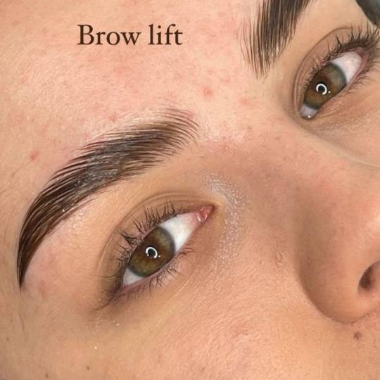 Studio Omega #novisad Obrve Brow lift Brow lift je tretman koji podiže, oblikuje i fiksira prirodne