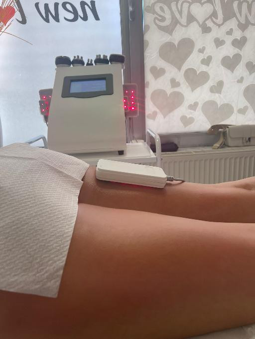 Lipolaser Centar - Matrix021 #novisad Tretmani tela