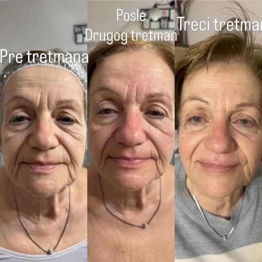 Amelie touch beauty usluga