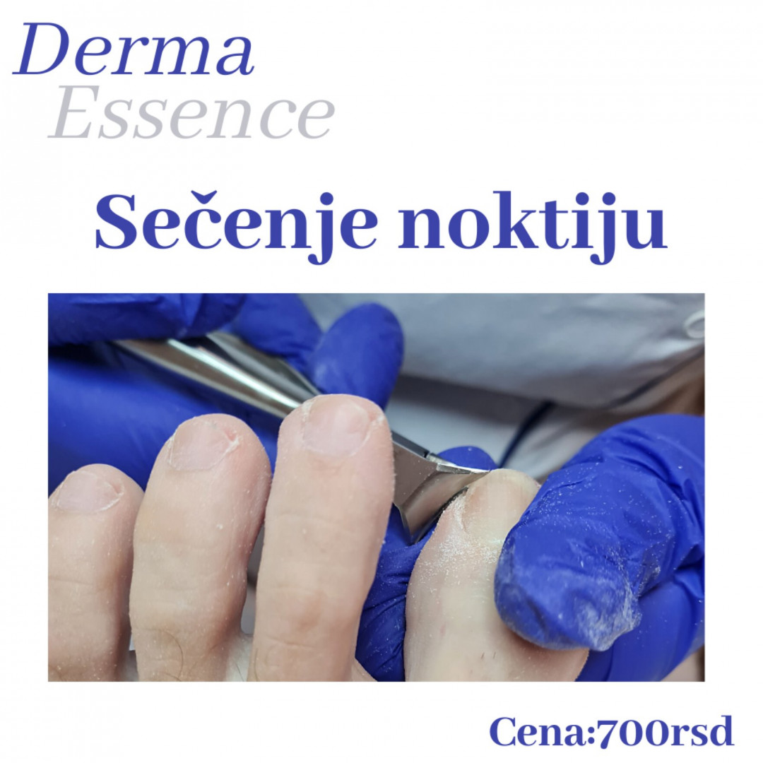 Derma Essence #nis Estetski pedikir Sečenje i oblikovanje zdravih noktiju