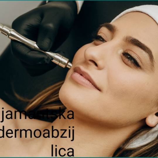 Laser centar Delight #beograd Mikrodermoabrazija Dijamantska mikrodermoabrazija Mikrodermoabrazija i