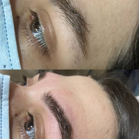Fam Beauty Box #beograd Depilacija toplim voskom