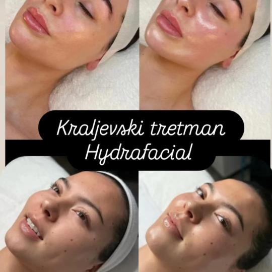 Ceragem Relax usluga