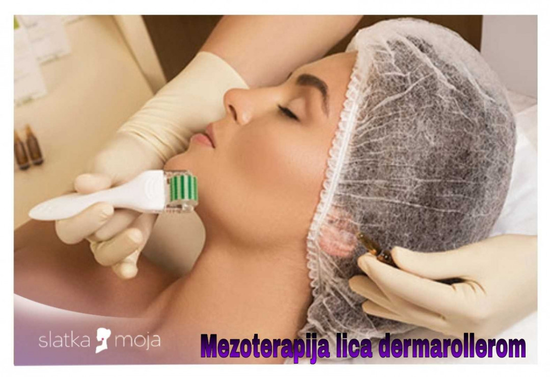 Slatka moja #beograd Mezoterapija lica Mezoterapija lica - dermapen mikroiglice
