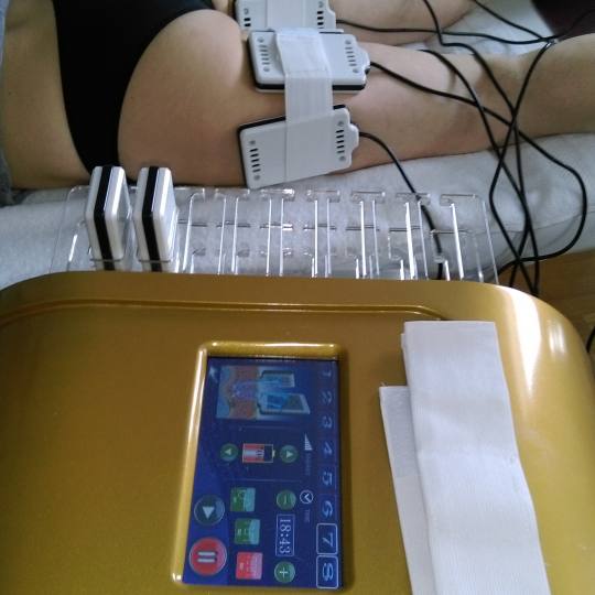 Mon cheri Anđela #beograd Lipolaser -anticelulit program