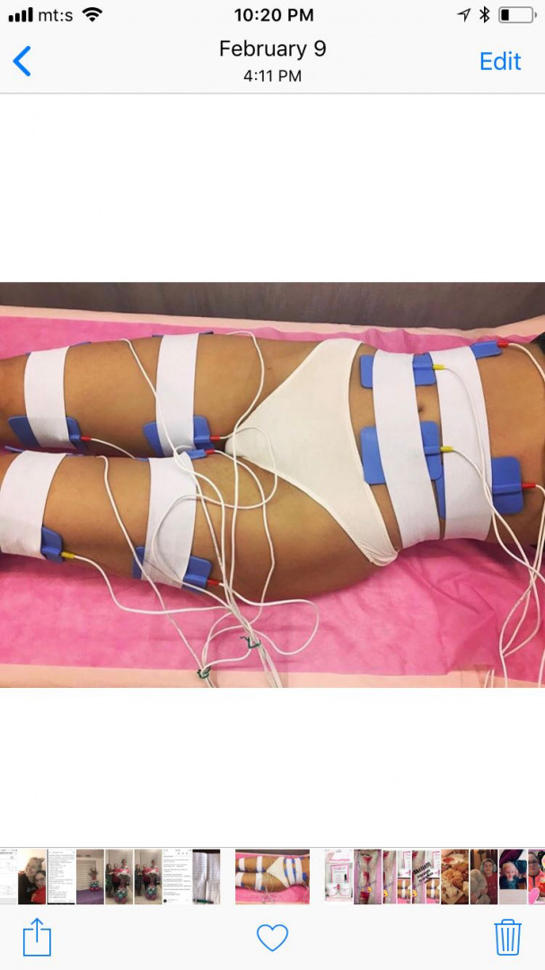 Body Beauty Balance 2020 #beograd Elektrostimulacija mišića
