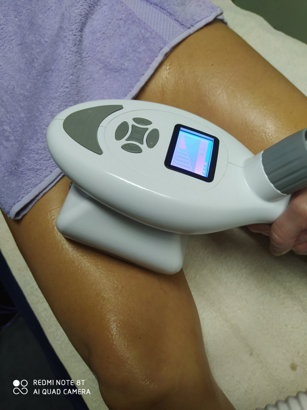 21 Beauty Centar #beograd Tretmani tela ReShape Body - celo telo