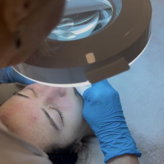 Sandra estetik studio #beograd Tretman lica Higijenski tretman lica Koža je temeljno očišćena, o