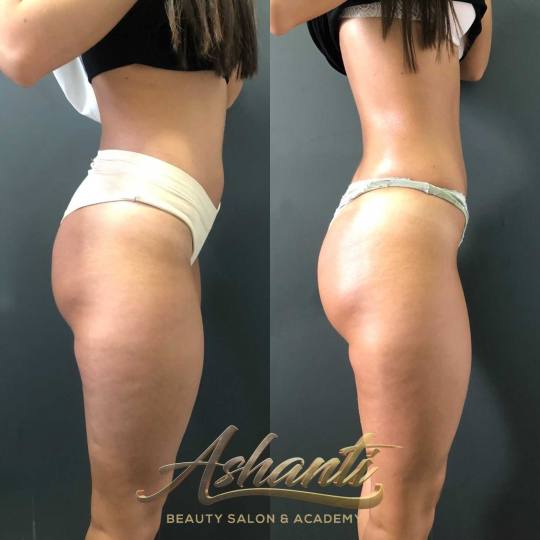 Ashanti Beauty Salon & Academy #beograd Anticelulit masaža 10 tretmana premium maderoterapije