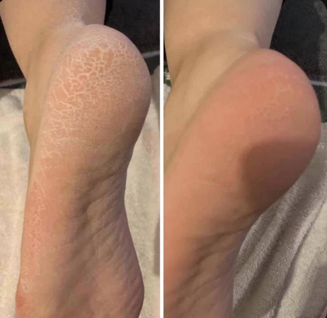 Pedikir - Amelini beauty concept, Beograd Estetski pedikir Nokti Estetski pedikir, Beograd, Zemun Centar