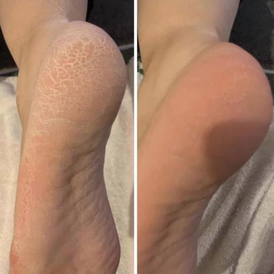 Amelini beauty concept #beograd Estetski pedikir Pedikir