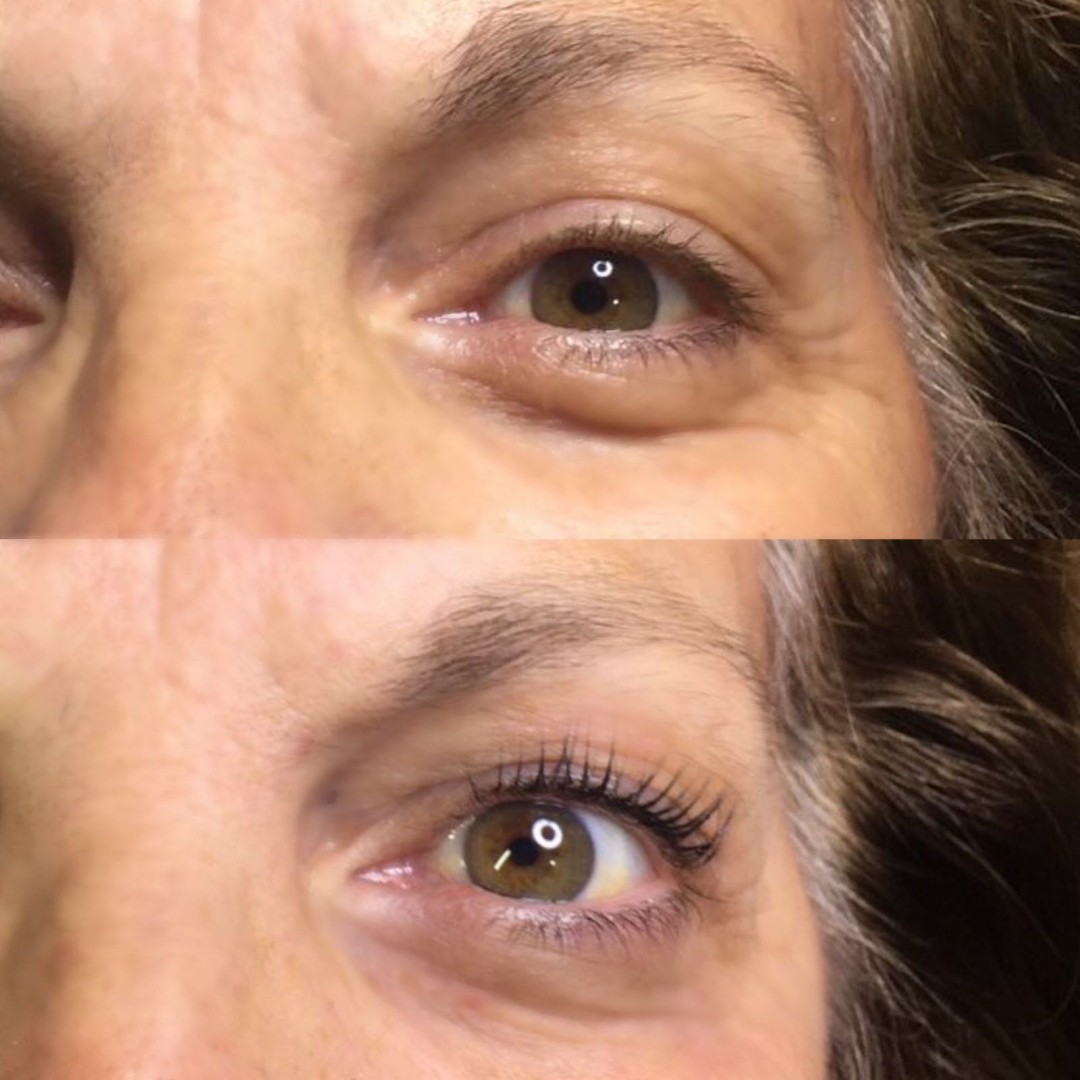 Fenix #beograd Trepavice Lash lift + farbanje trepavica