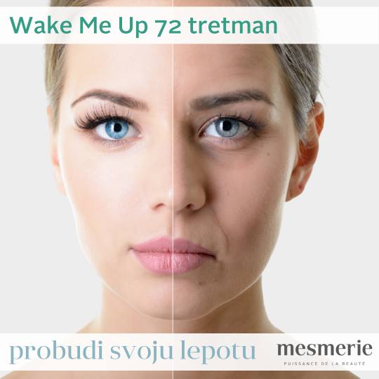 Vila Beauty Studio #beograd Tretman lica Wake me Up tretman lica Wake Me Up 72 tretman je instant re