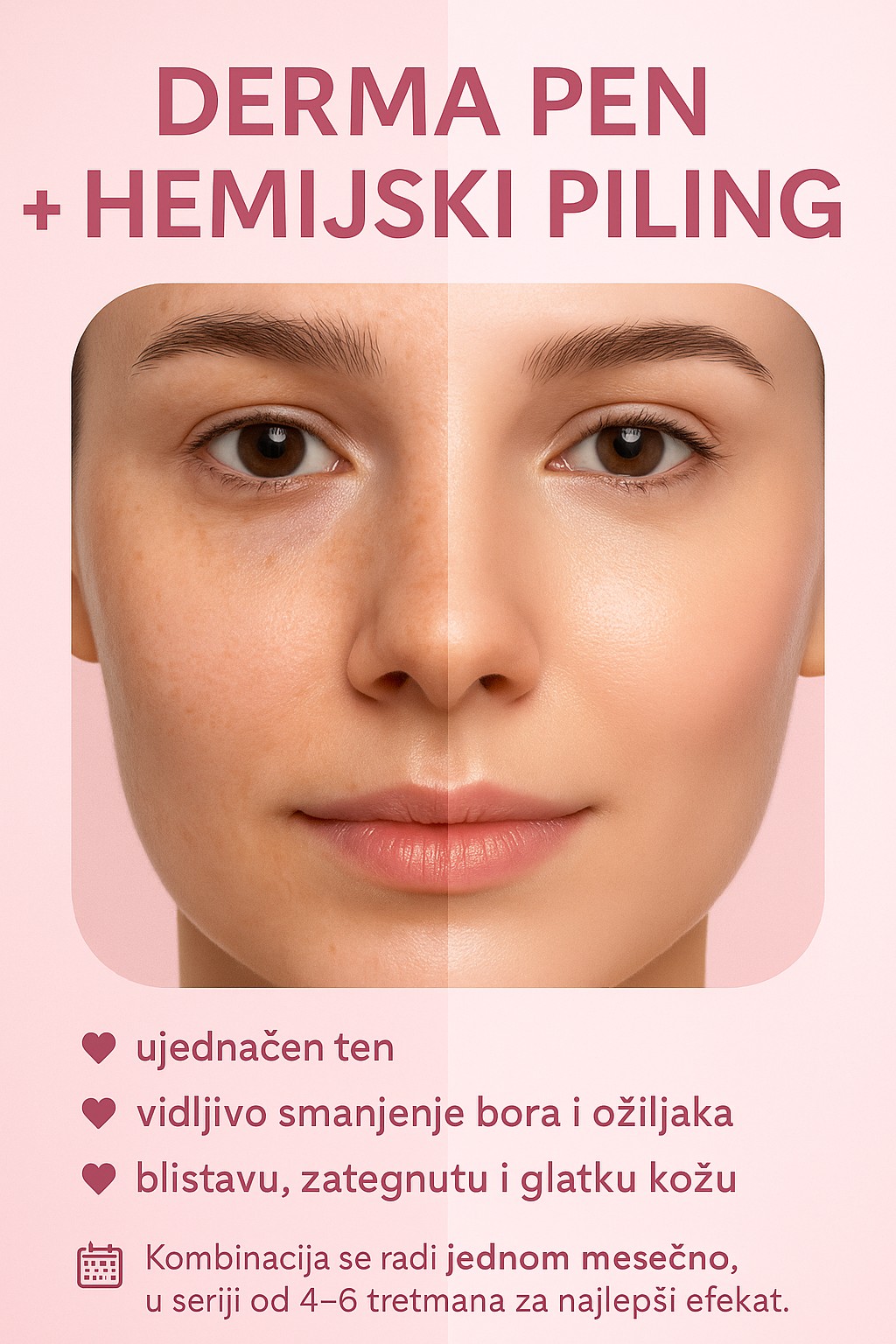 Xenija Beauty Room #beograd Tretman lica Hemijski piling lica