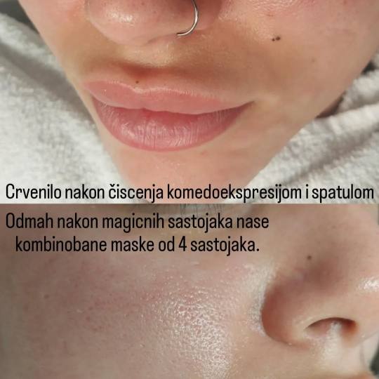 LYS by Royal Beauty Switzerland usluga