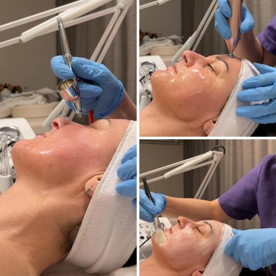 In line 1 #pancevo Tretmani protiv bora Oxygen i Plazma lift lica - zatezanje lica Kombinacija kiseo