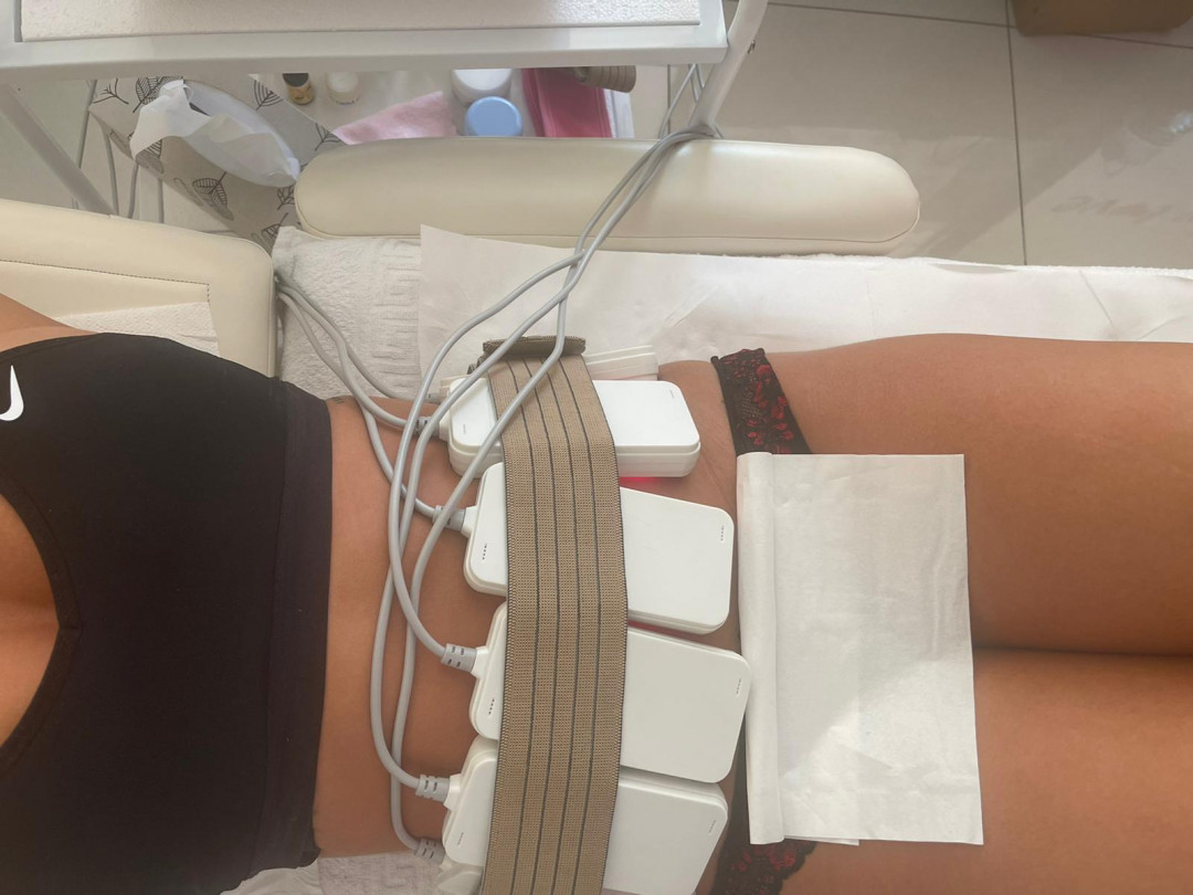 Lipolaser Centar - Matrix021 #novisad Tretmani tela