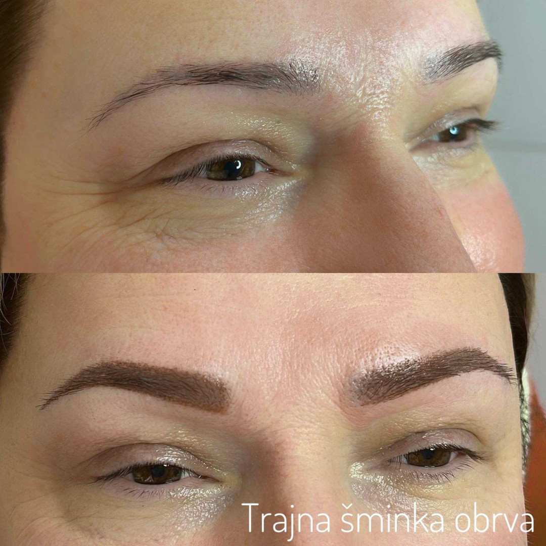 Iris + #beograd Tretman lica Higijenski tretman lica - za problematičnu kožu