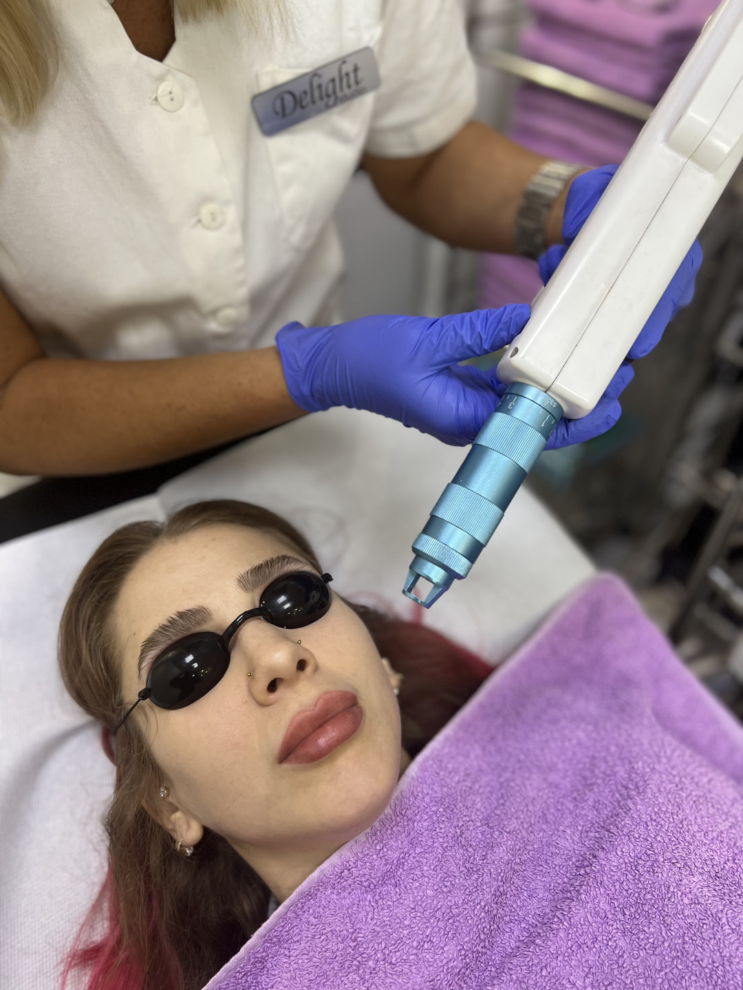 Uklanjanje pega i fleka laserom - Laser centar Delight, Beograd Laserski tretmani lica Lice Laserski tretmani lica, Beograd, Palilula centralni deo